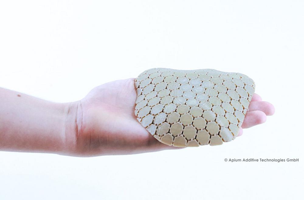 Schädelimplantate aus dem 3D-Drucker